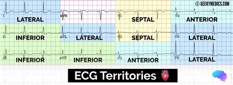 Understanding An Ecg Ecg Interpretation Geeky Medics