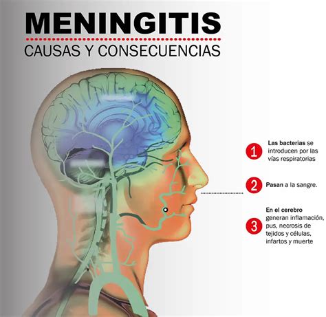 Neumococo Qué es para qué sirve significado y más