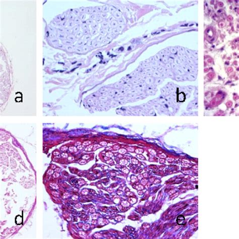 Histological Examination Of Hematoxylin And Eosin H E Stained Femoral