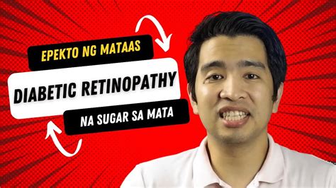 Diabetic Retinopathy Epekto Ng Mataas Na Sugar Sa Mata Diabetes