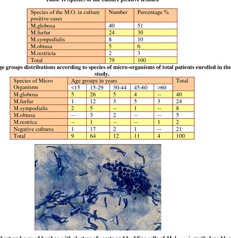 Table 2 From Isolation And Identification Of Malassezia Species In