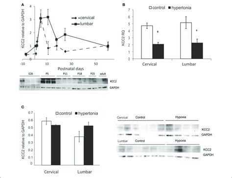 Expression Of Potassium Chloride Transporter KCC2 In Normal