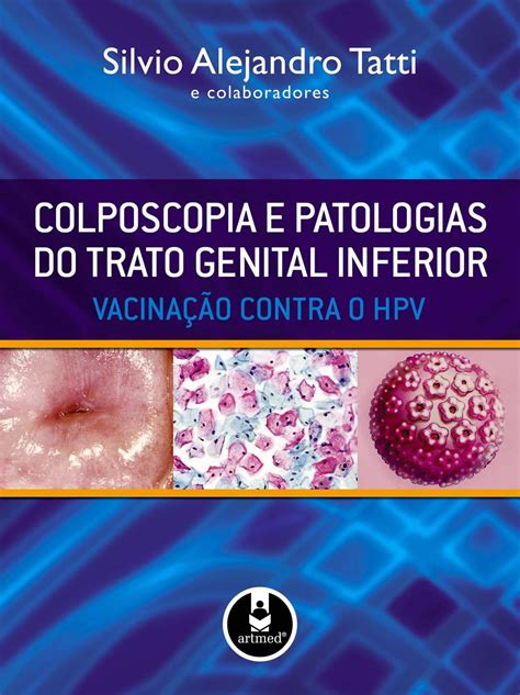 Livro Colposcopia E Patologias Do Trato Genital Inferior Livros De