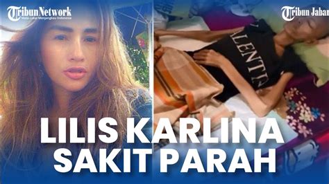 Fakta Mengejutkan Kondisi Terbaru Lilis Karlina Pedangdut Goyang