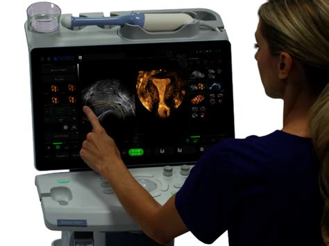 Voluson™ Swift Ultrasound System Ge Healthcare