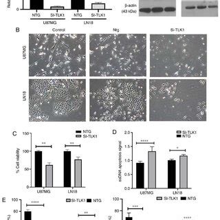 TLK1 Knockdown Decreases Tumorigenicity In Nude Mice A Tumour Sizes