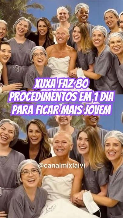 Xuxa Realiza 80 Procedimentos Estéticos Ao Longo De 7 Horas Youtube