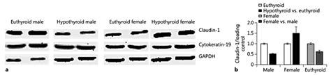 Sex Dependent Claudin 1 Expression In The Liver Of Euthyroid And