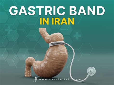 Gastric Band In Iran CareFulTrip