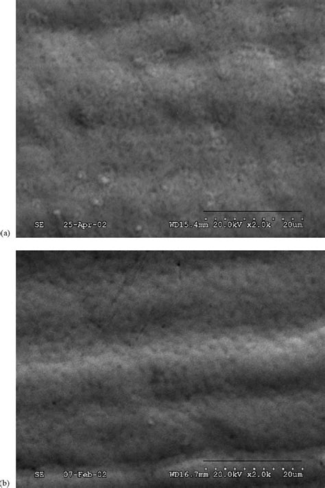 Sem Micrographs Of The Electroless Ni P Deposits From The Plating