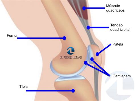 O que é Condromalácia Patelar Especialista do Joelho