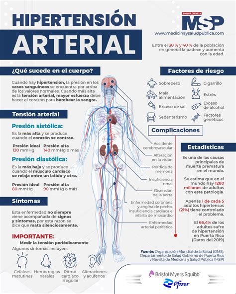 Hipertensión Arterial