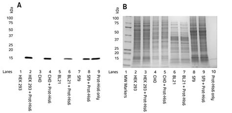 Western Blotting Guide Part 1 Introduction And Sample Preparation 2023