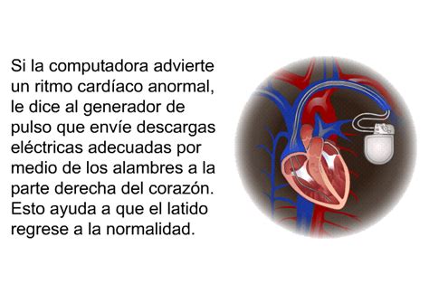 Patedu Desfibrilador Cardioversor Implantable