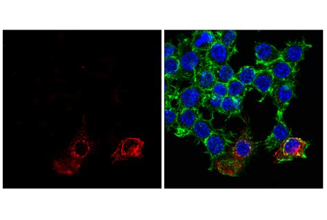 Cd11c D1v9y Rabbit Mab Alexa Fluor® 647 Conjugate Cell Signaling Technology