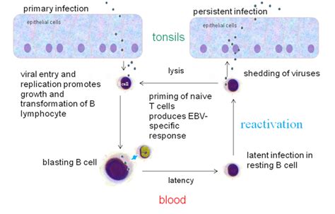 1525c Other Diseases And Epstein Barr Virus Biology Libretexts