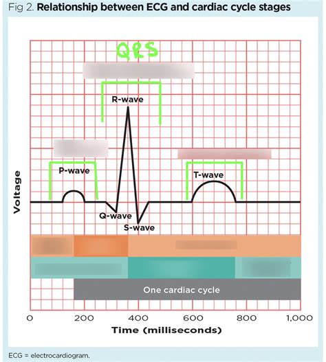 Ecg Reading Diagram Quizlet