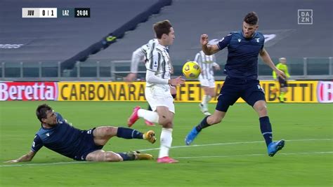 Moviola Juve Lazio Hoedt Tocca Palla Col Braccio Larbitro Non Dà