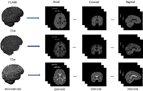 Figure 1 From Multi Branch Convolutional Neural Network For Multiple Sclerosis Lesion