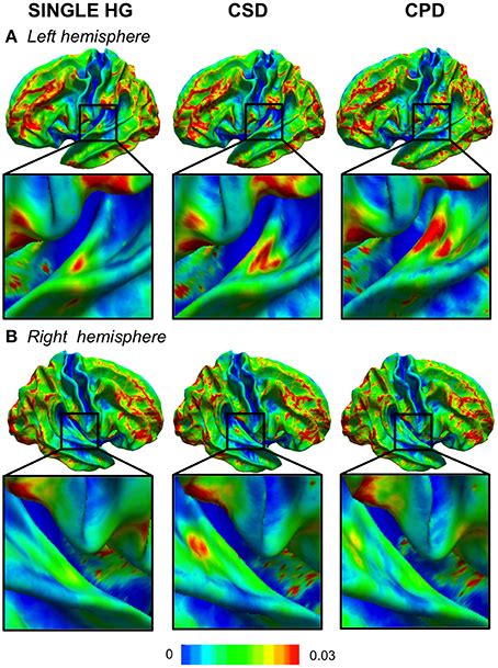 Frontiers Surface Based Morphometry Of Cortical Thickness And Surface