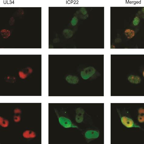 Indirect Immunofluorescence Was Performed On Primary Human Fibroblasts