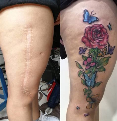 Tatuagem Em Cicatriz 70 Melhores Tattoos Para Cobrir Cicatriz Com