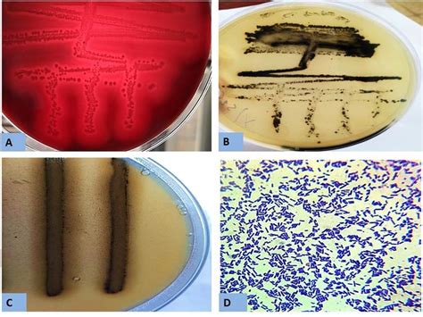 Clostridium Perfringens Gram Stain