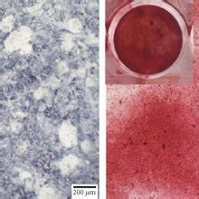 Impaired Proliferation Adhesion And Differentiation Capability Of