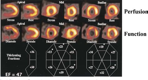 Figure 1 From Incremental Value Of Combined Perfusion And Function Over