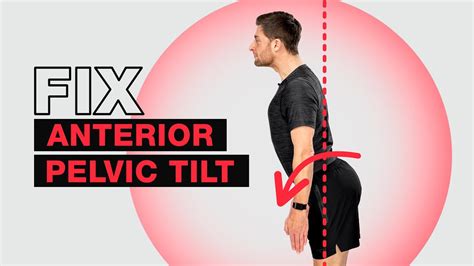 Fix Anterior Pelvic Tilt Fast Youtube