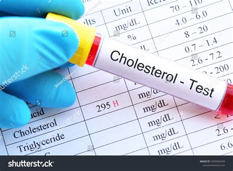 abnormal nutrition images stock   objects vectors