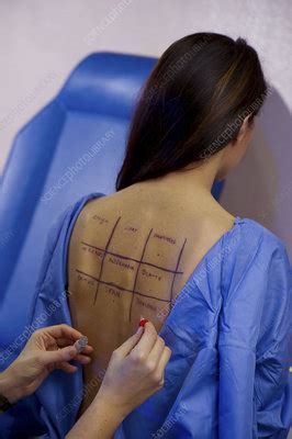 Allergy Test Stock Image C Science Photo Library