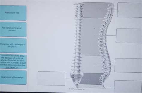 Solved Attaches to ribs. No canals or foramen present | Chegg.com