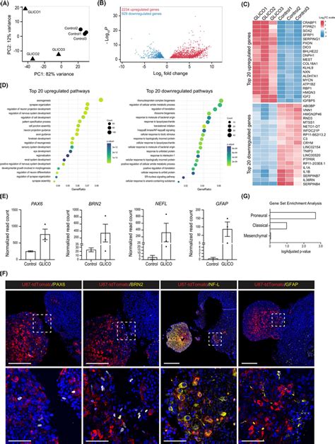 Coculture Of Glioblastoma Cells With COs Significantly Changes Their