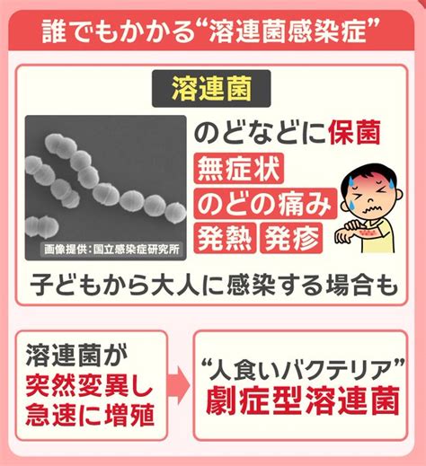 “致死率3割”急増する劇症型溶連菌 「数時間前まで話していた患者が」救急医が進行の速さ語る 今年の患者数977人で既に去年1年間を上回る