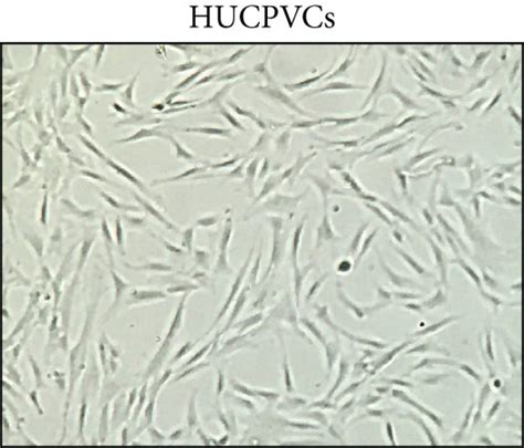 Characterization Of Human Umbilical Cord Perivascular Cells Hucpvcs