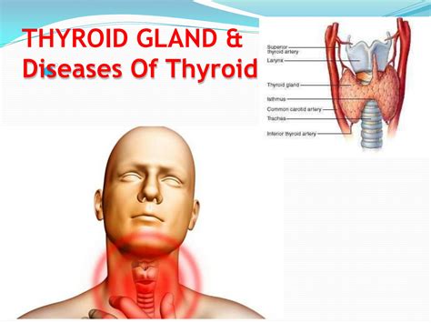 Solution Thyroid Gland And Its Disease Studypool