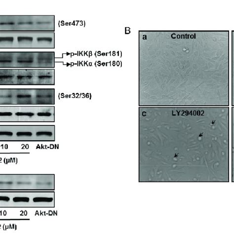 Effect Of Akt Inhibition On The Expression Of P Akt Ser Akt