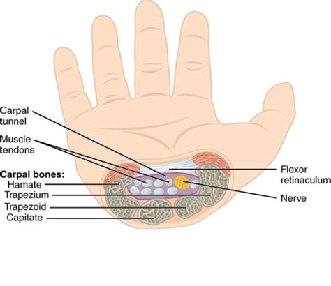 Carpal Tunnel Syndrome Median Nerve Orthopaedics Geeky Medics