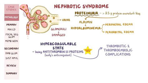 Nephrotic syndromes: Pathology review: Video | Osmosis