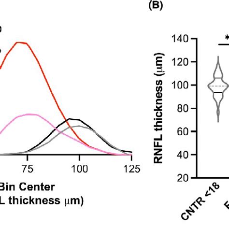 RNFL thickness correlates with neurological severity in FRDA. RNFL ...