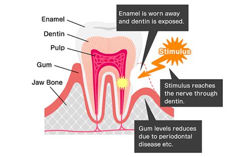 sensitive teeth teethorgau