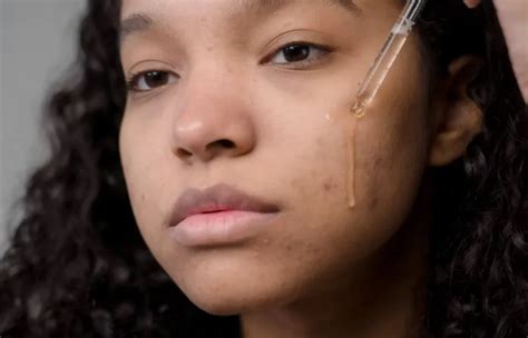 Cerave Skincare Routine For Acne Prone Skin Effective And Affordable