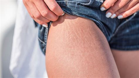 Top Cremas Anti Estr As Y Celulitis Para Cuidar Tu Piel Este Verano