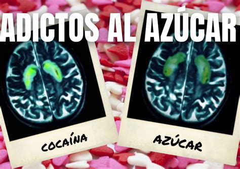 Adicción Al Azúcar ¿es El Azúcar Una Droga