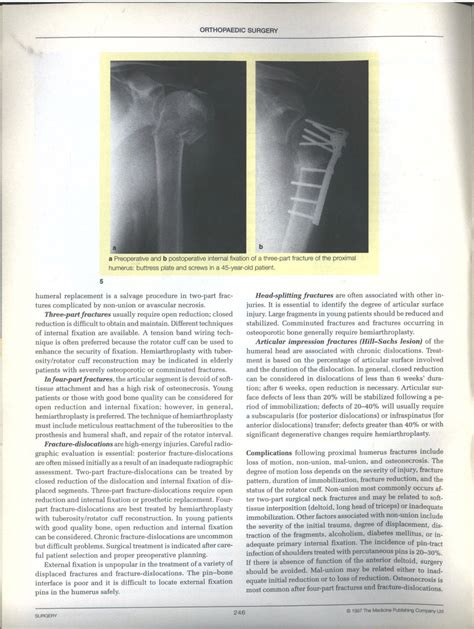 Fractures of the shoulder and humerus | Download Scientific Diagram