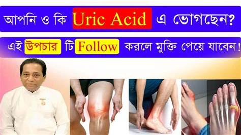 Uric Acid क्या है Uric Acid First Aid Uric Acid Food To Avoid In Winter Youtube