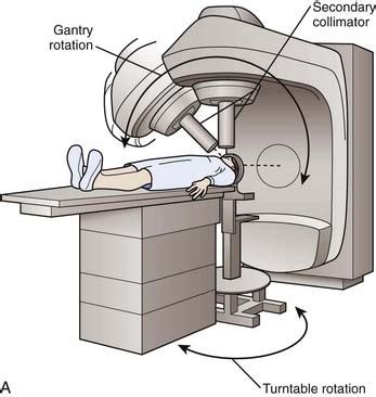 Radiosurgery Clinical Gate