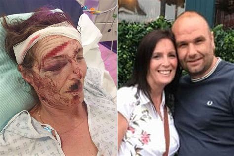 Newlywed Couples Horrific Wounds After They Were Ambushed By 12 Strong