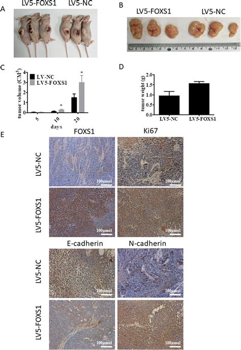 Foxs Promotes Gastric Cancer Cell Growth And Altered The Expression Of